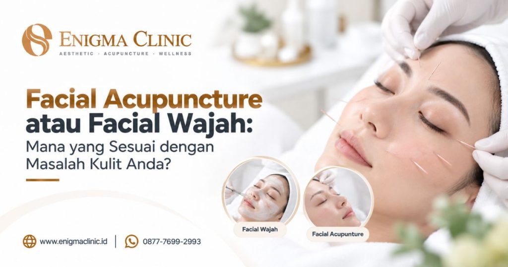 Facial Acupuncture atau Facial Wajah: Mana yang Sesuai dengan Masalah Kulit Anda?