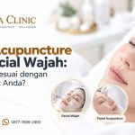 Facial Acupuncture atau Facial Wajah: Mana yang Sesuai dengan Masalah Kulit Anda?